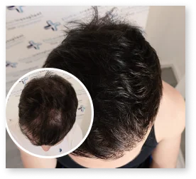 PRP Ergebnis Patient 10