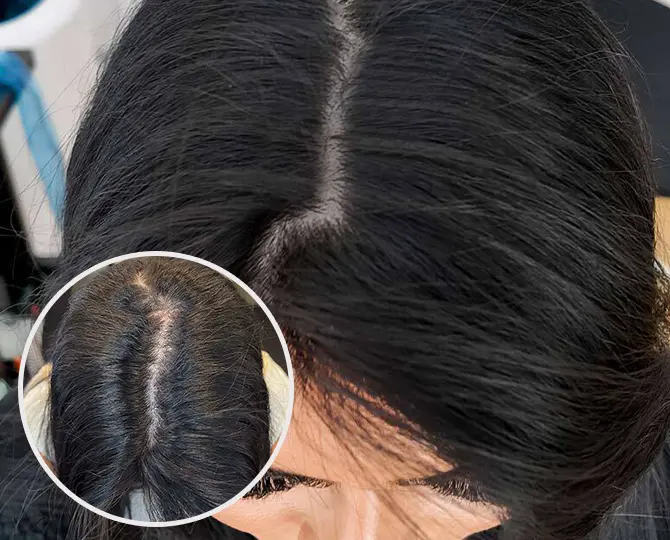 PRP Ergebnis Patient 7