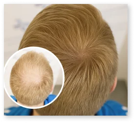 PRP Ergebnis Patient 9